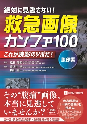 絶対に見逃さない！救急画像カンファ 100　腹部編**診断と治療社/松田 剛明/978-4-7878-2685-5/9784787826855**