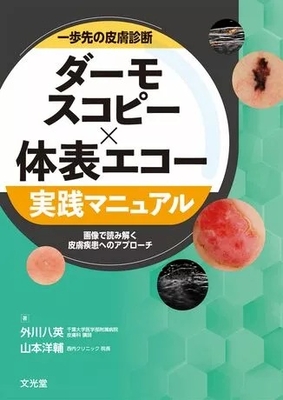ダーモスコピー&times;体表エコー実践マニュアル**文光堂/外川　八英/978-4-8306-3485-7/9784830634857**