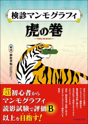 検診マンモグラフィ虎の巻**中外医学社/植松 孝悦/978-4-498-12200-0/9784498122000**