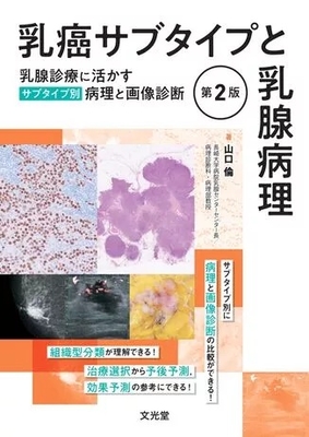 乳癌サブタイプと乳腺病理　第2版**文光堂/山口　倫/978-4-8306-2351-6/9784830623516**