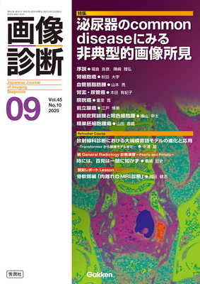 画像診断 2025年9月 泌尿器のcommon diseaseにみる非典型的画像所見（Vol.45 No.10）**Gakken/9784055201247**