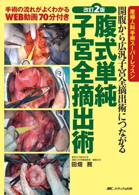 腹式単純子宮全摘出術 改訂2版**メディカ出版/田畑 務/978-4-8404-8815-0/9784840488150**