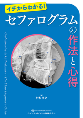 イチからわかる！ セファログラムの作法と心得**クインテッセンス出版/村松 裕之/978-4-7812-1150-3/9784781211503**