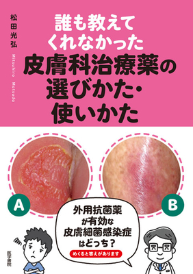 誰も教えてくれなかった 皮膚科治療薬の選びかた・使いかた**医学書院/松田 光弘/978-4-260-06549-8/9784260065498**