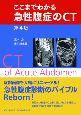 ここまでわかる急性腹症のCT　第４版**ＭＥＤＳｉ/荒木　力/978-4-8157-3153-39784815731533**
