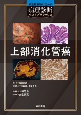 癌治療戦略に活かす病理診断ベストプラクティス　上部消化管癌**中山書店/青笹　克之/978-4-521-75065-1/9784521750651**