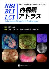 新しい診断基準・分類に基づいた NBI/BLI/LCI内視鏡アトラス