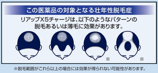 この医薬品の対象となる壮年性脱毛症