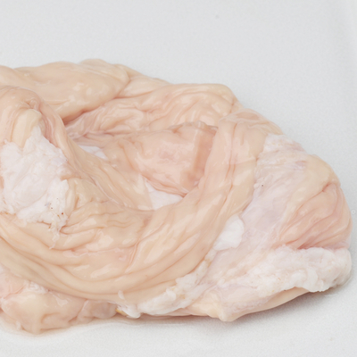 直腸1kg