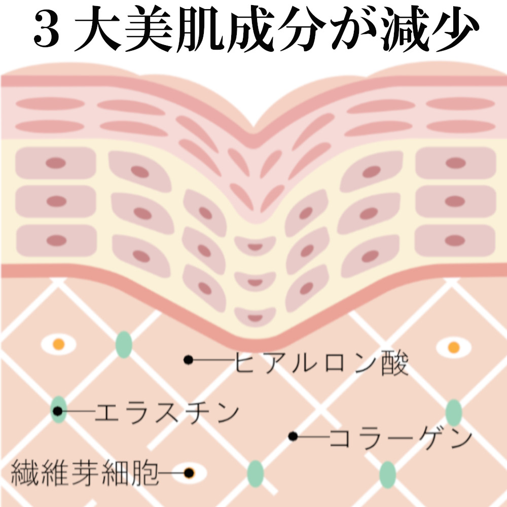 ３大美容成分が減少すると、しわたるみの原因に